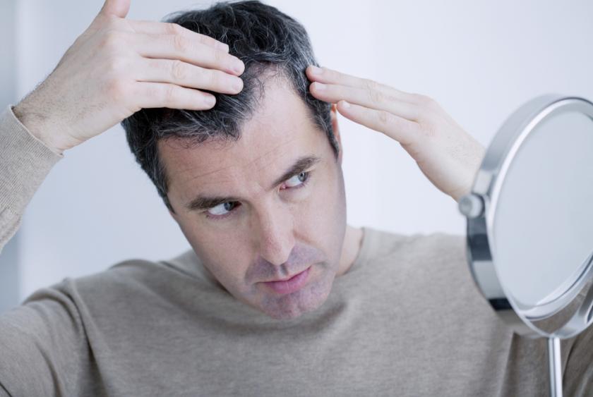 10 misconceptions about hair transplant treatment | Kosmoderma