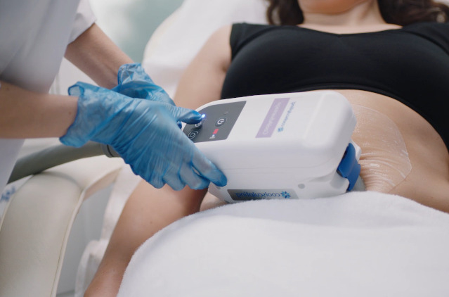 CoolSculpting – A Noninvasive Procedure To Stay In Shape | Kosmoderma