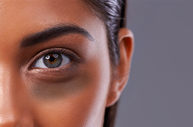 Tear Trough Treatment- Under-eye Care For A Radiant Look | Kosmoderma