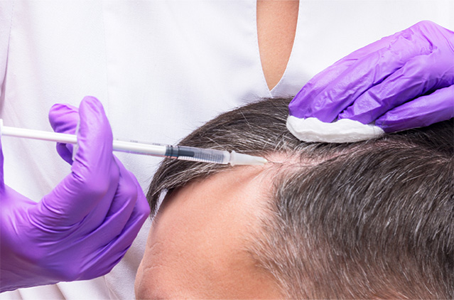 GFC vs. PRP: What’s Best for You? Growth Factor Therapy for Hair: 10 Myths Debunked | Kosmoderma