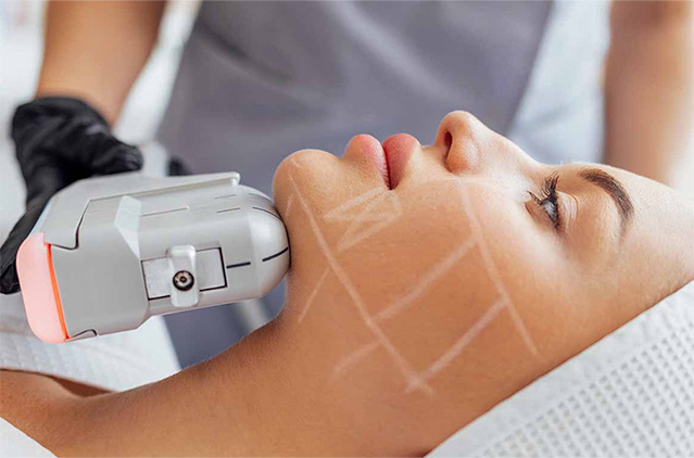 HIFU Anti-Aging Non-Surgical Facelift: Is it Good for Your Face, Neck, and Body? | Kosmoderma