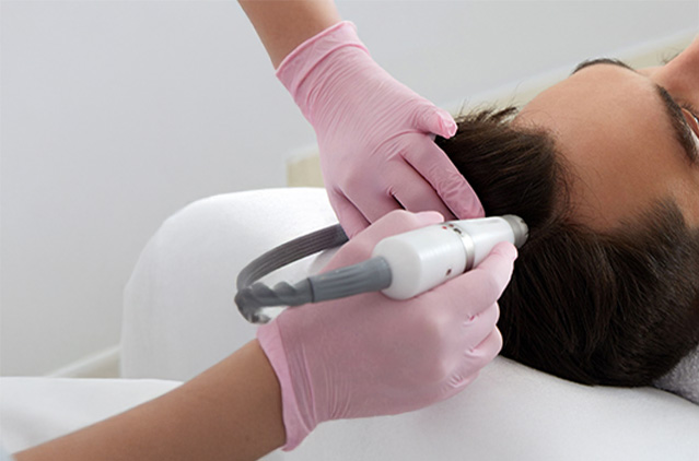 Scalp Fraxel Laser: The Game-Changer in Hair and Scalp Care | Kosmoderma