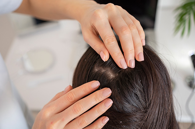 Are You A Suitable Candidate For Prp Hair Fall Therapy? | Kosmoderma