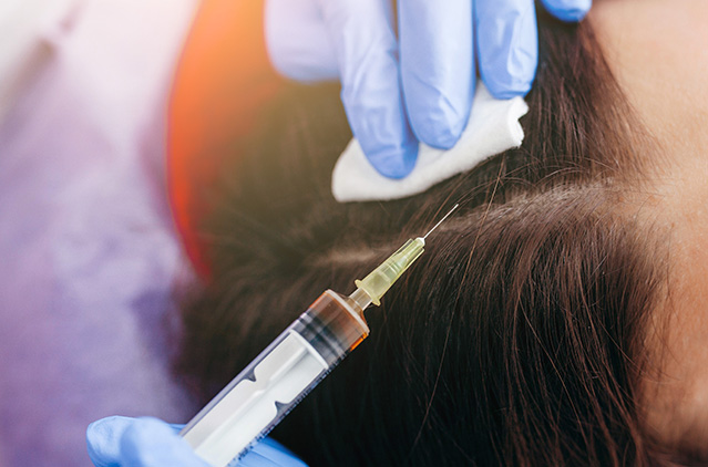 PRP Hair Treatment In Delhi – To Stimulate And Thicken Hair Growth | Kosmoderma