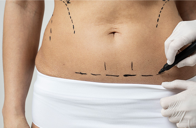 Here’s All You Want To Know About Liposuction In Mumbai! | Kosmoderma