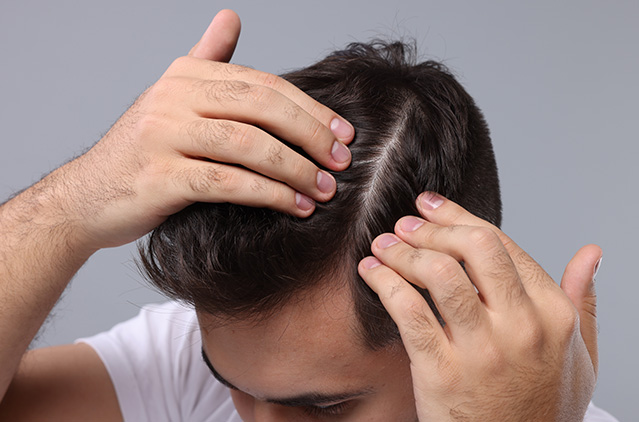 Regenera Activa – A Powerful, Safe, Effective, And Painless Hair Loss Treatment! | Kosmoderma