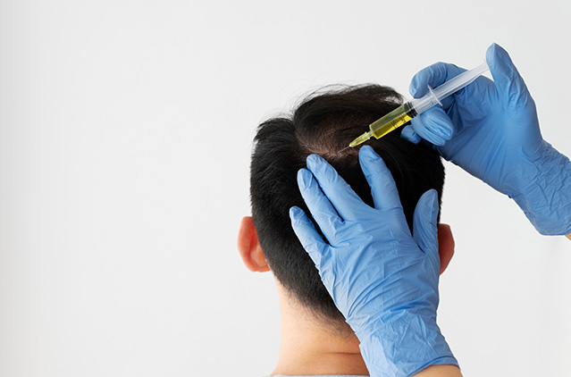 The GFC Hair Treatment Cost And Success Rate! | Kosmoderma