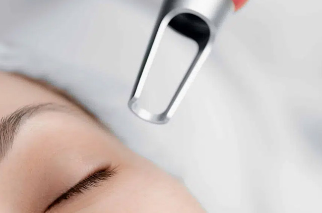 Pico Laser Treatment at Kosmoderma Skin, Hair, Body Care Clinics | Kosmoderma