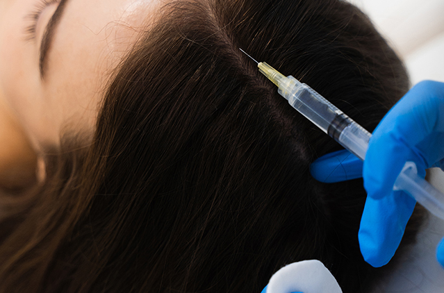 Decoded: What Makes The Qr678 The Best Hair Loss Treatment! | Kosmoderma