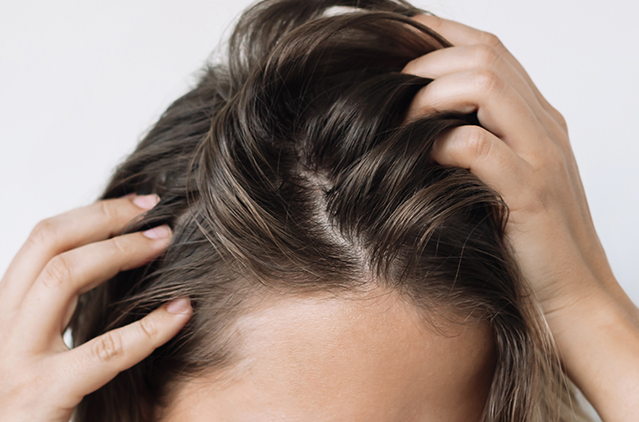 Gfc Treatment – To Encourage Growth Of New, Healthy, Thick, And Strong Hair! | Kosmoderma