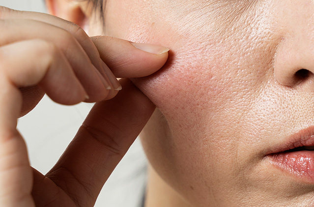 Top Anti-aging Treatments To Make You Look And Feel Younger Again! | Kosmoderma