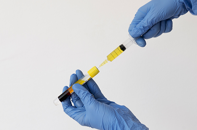 Is PRP Therapy Necessary After a Hair Transplant? Experts Weigh In | Kosmoderma