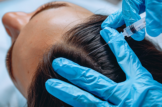 Combined PRP and GFC Treatment for Hair Loss | Achieve Denser, Fuller Hair | Kosmoderma