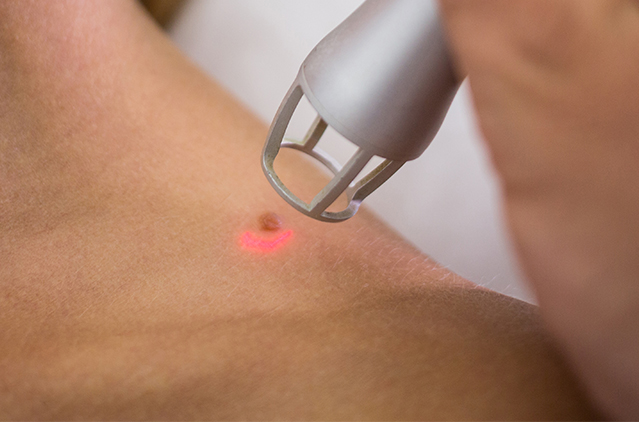 Why Everyone Is Talking About PDRN Injection & the “Salmon Sperm Facial” | Kosmoderma