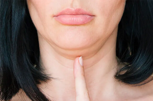 How to Reduce Chin Fat: Expert Methods That Actually Work | Kosmoderma