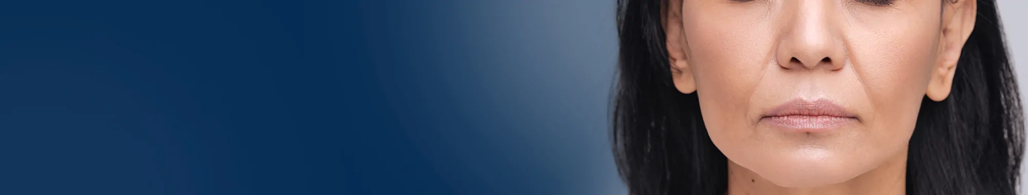 Laugh-Line-Correction-1-42