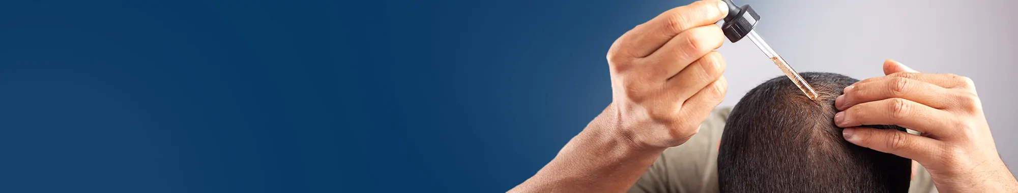 Minoxidil-Scalp-Treatment-61