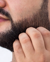 Beard Transplantation