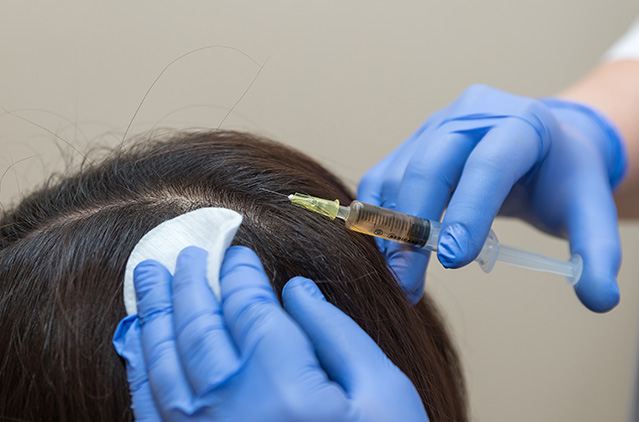 Growth Concentrate Factor Therapy Vs Hair Transplant: Which Hair Growth Restoration Treatment Is Best For You? | Kosmoderma