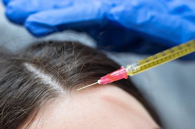 How much does PRP therapy cost — and what results should you expect? | Kosmoderma