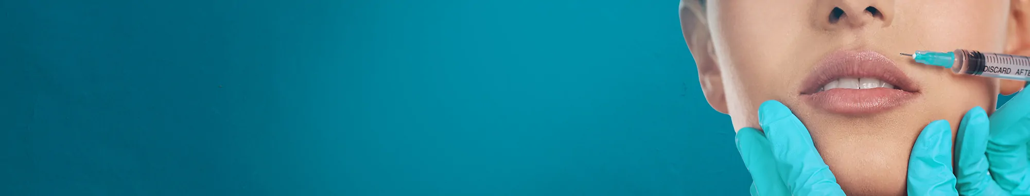 Lip-fillers-39