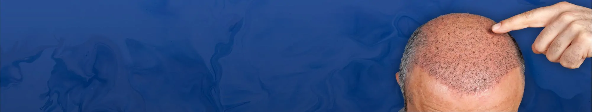 PowerClip-Rectangle-12-2-51