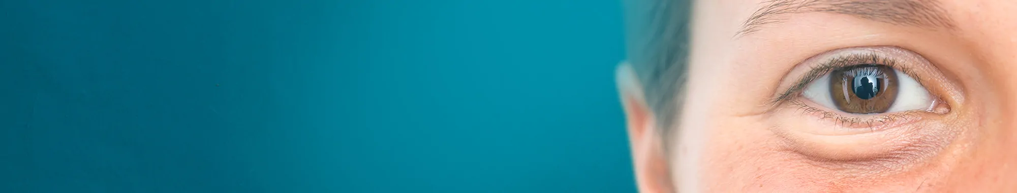 Undereyes-Puffiness-Reduction-45