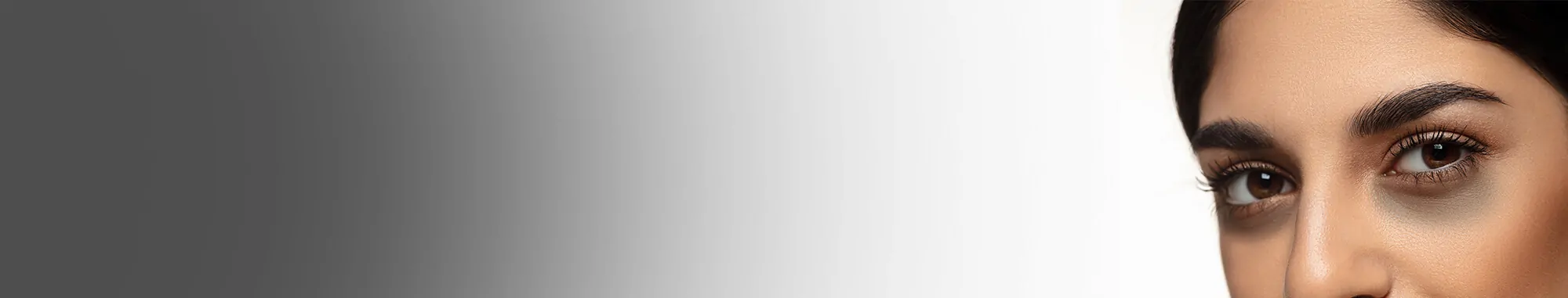 tear-trough-treatment-33